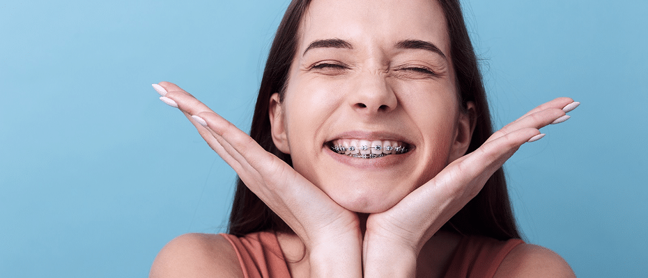 multi attaches metalliques appareil orthodontique bessines Multi-attaches métalliques Orthodontie de l'enfant Cabinet d’orthodontie du Dr Colas et du Dr Rivière